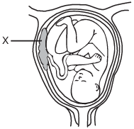 reproduction and development, human female reproductive system fig: lenv12016-examw_g4.png